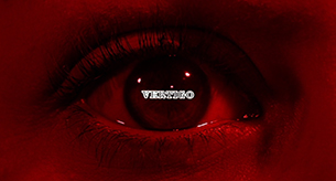 Vertigo